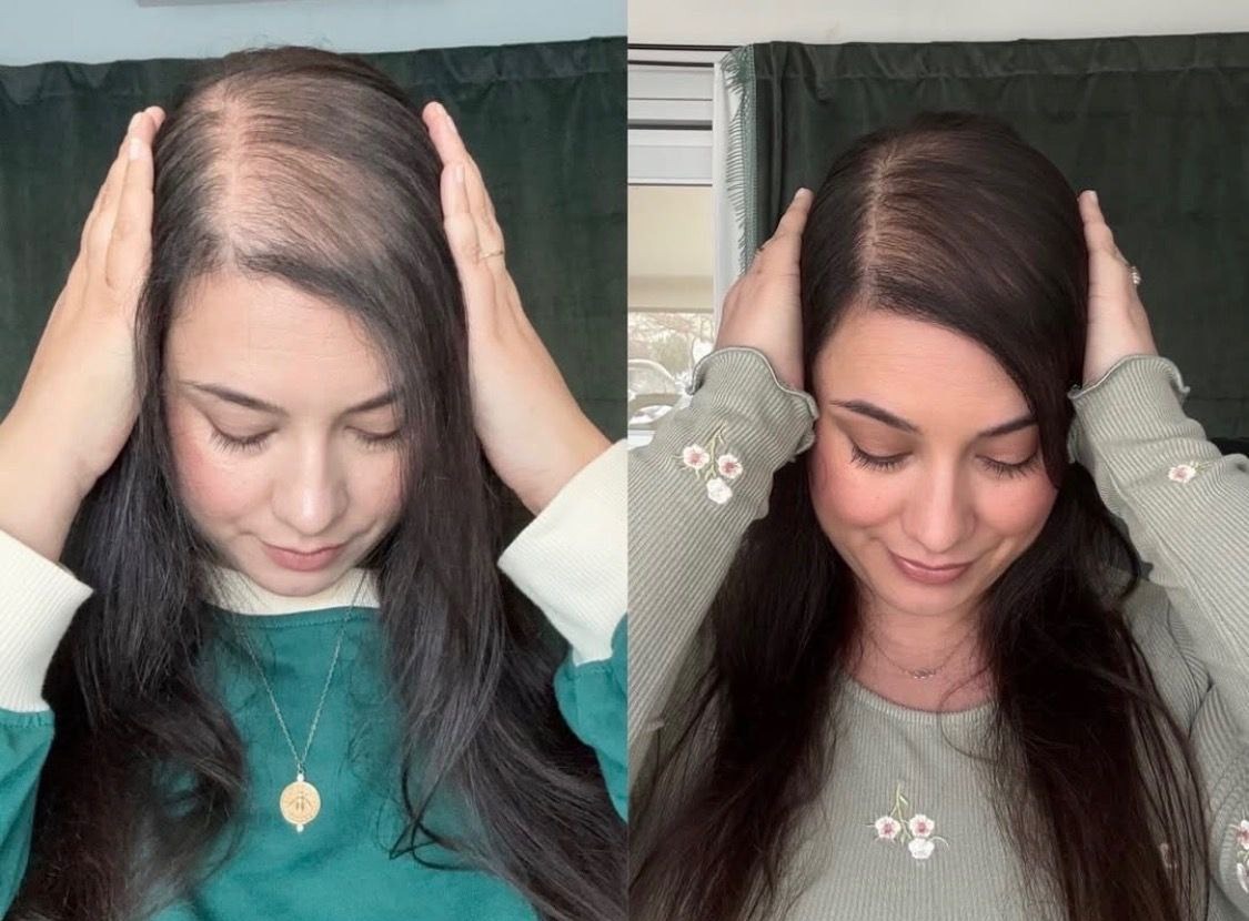 Before and After — front view